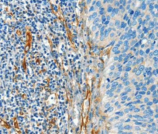 Anti-Human/Mouse/Rat DIO2 Antibody