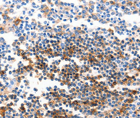 Anti-Human/Mouse GJB6 Antibody - ABMIUM