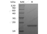 Recombinant Human Interleukin-16/IL-16 Protein - ABMIUM