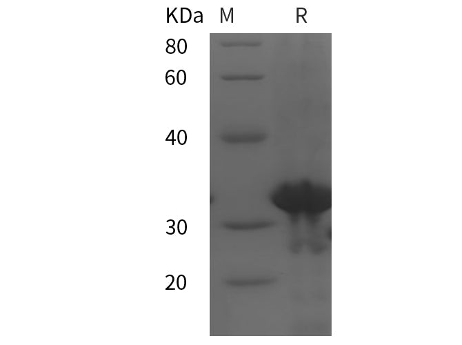 SDS-PAGE analysis of Human FGF23 proteins, 2 μg/lane of Recombinant Human FGF23 proteins was resolved with SDS-PAGE under reducing conditions, showing bands at 32 kDa.