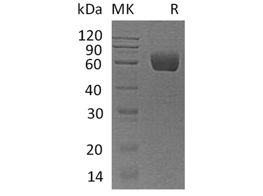 Recombinant Human Angiotensinogen/AGT Protein (His Tag) - ABMIUM