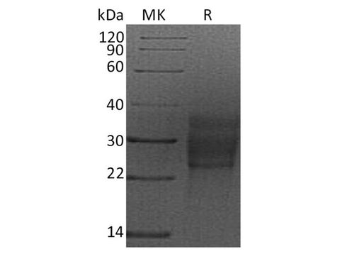 Recombinant Rat SCF/c-Kit Ligand Protein (Human Cells, His Tag) - ABMIUM