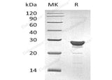 Recombinant Human MAA/GSTZ1 Protein (His Tag) - ABMIUM