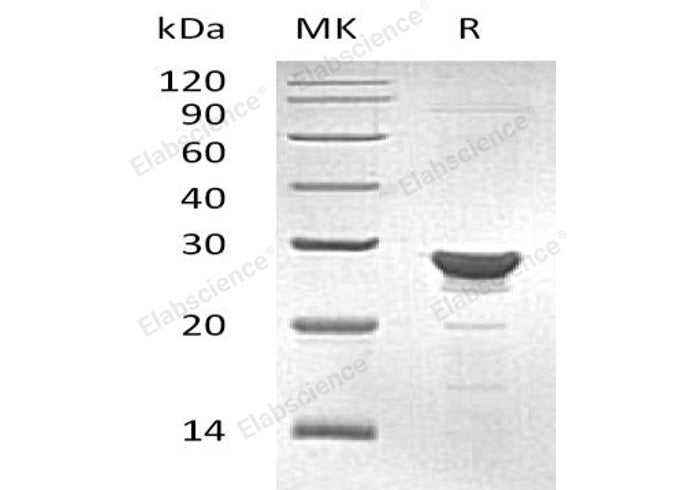Recombinant Human MAA/GSTZ1 Protein (His Tag) - ABMIUM