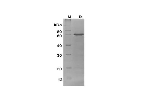 SDS-PAGE analysis of Human OCLN proteins, 2 μg/lane of Recombinant Human OCLN proteins was resolved with SDS-PAGE under reducing conditions, showing bands at 58 kDa.
