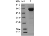 Recombinant Human VSIG4 Protein (Fc Tag) - ABMIUM