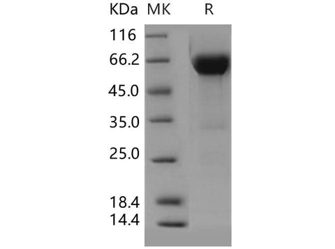 Recombinant Human VSIG4 Protein (Fc Tag) - ABMIUM