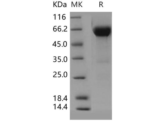 Recombinant Human VSIG4 Protein (Fc Tag) - ABMIUM