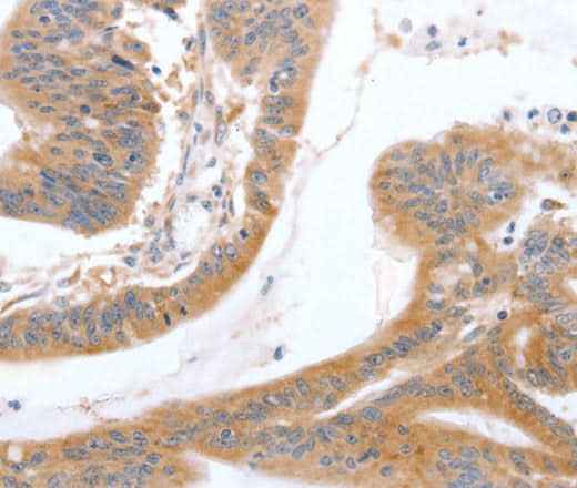 Anti-Human/Mouse/Rat TGFA Antibody