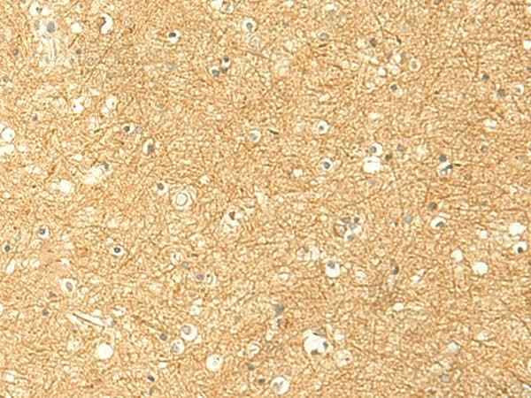 Anti-Human/Mouse RNF148 Antibody