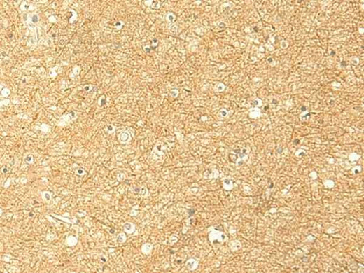 Anti-Human/Mouse RNF148 Antibody