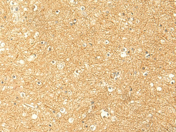 Immunohistochemistry of paraffin-embedded Human brain tissue using RNF148 Polyclonal Antibody at dilution of 1:50(×200)