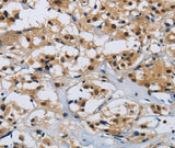 Anti-Human/Mouse CMTM8 Antibody - ABMIUM