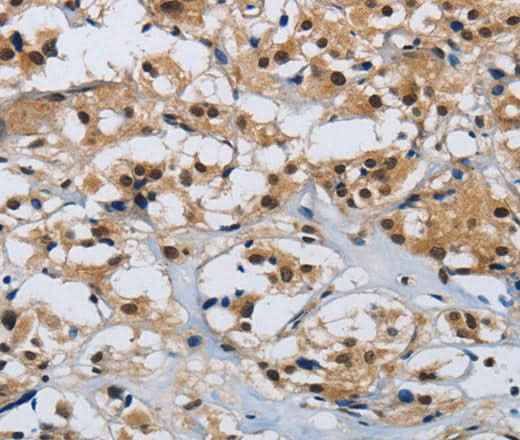Anti-Human/Mouse CMTM8 Antibody