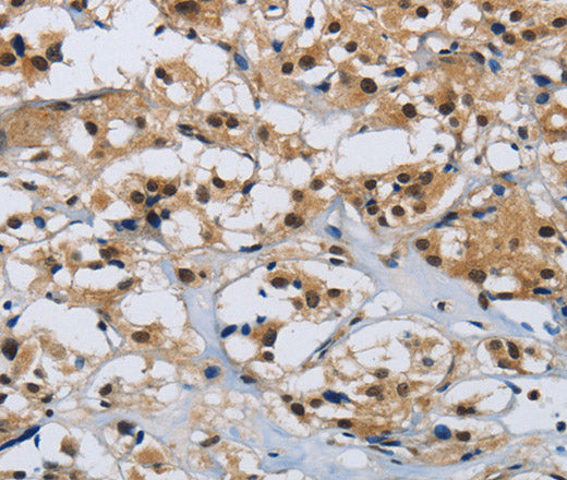 Anti-Human/Mouse CMTM8 Antibody - ABMIUM