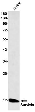 Western blot detection of Survivin in Jurkat cell lysates using Survivin Rabbit mAb(1:500 diluted).Predicted band size:16kDa.Observed band size:16kDa.