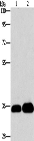 Anti-Human LIN28B Antibody - ABMIUM
