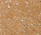Anti-Human/Mouse/Rat SYTL5 Antibody - ABMIUM