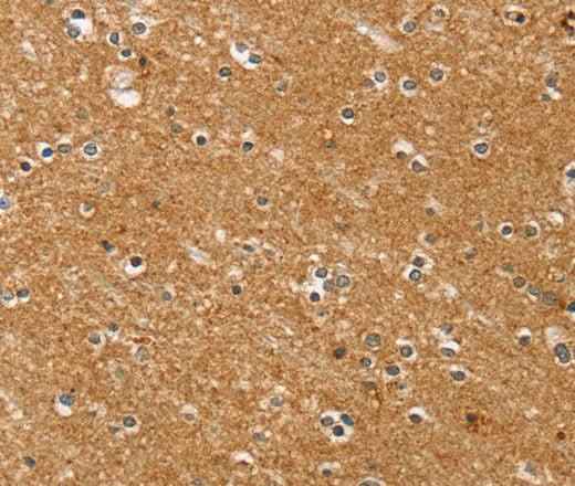Anti-Human/Mouse/Rat SYTL5 Antibody