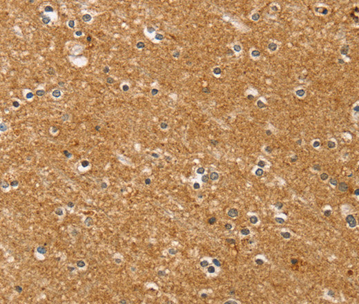 Anti-Human/Mouse/Rat SYTL5 Antibody - ABMIUM
