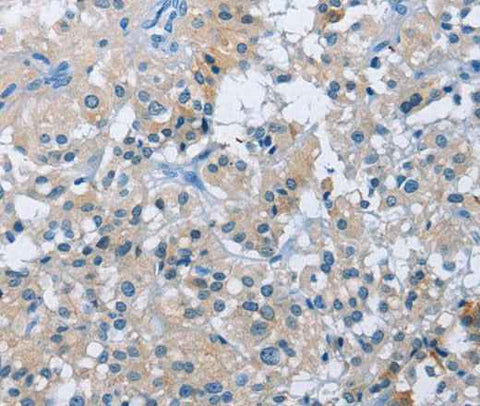 Anti-Human BTN2A2 Antibody