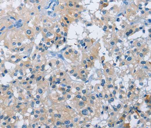 Anti-Human BTN2A2 Antibody - ABMIUM