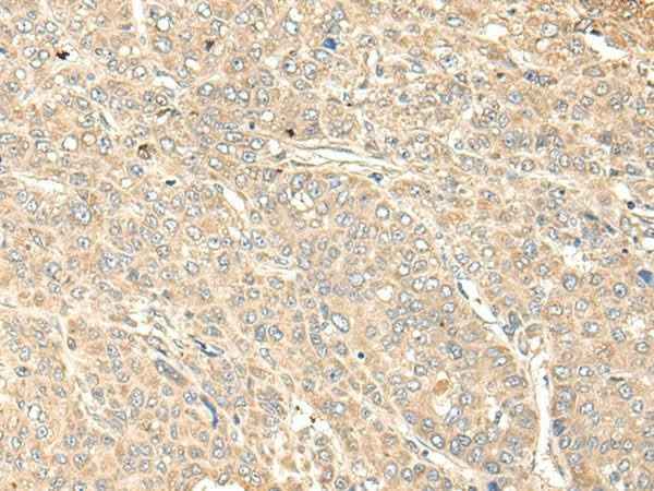 Anti-Human WDFY4 Antibody