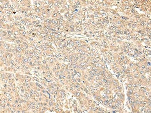 Anti-Human WDFY4 Antibody