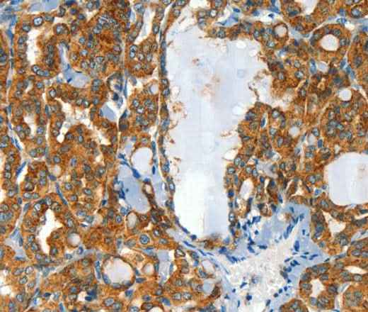 Anti-Human CLPTM1L Antibody