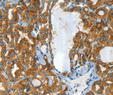 Anti-Human CLPTM1L Antibody - ABMIUM