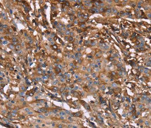 Anti-Human HP Antibody