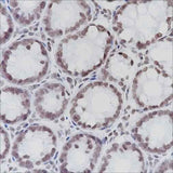Anti-Human/Rat/Mouse ERCC1 Antibody [A216]