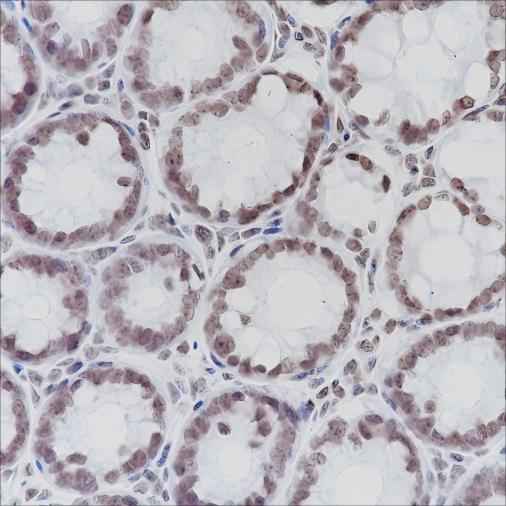 Anti-Human/Rat/Mouse ERCC1 Antibody [A216] - ABMIUM