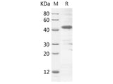 SDS-PAGE analysis of Rat C4a proteins, 2 μg/lane of Recombinant Rat C4a proteins was resolved with SDS-PAGE under reducing conditions, showing bands at 42 kDa.
