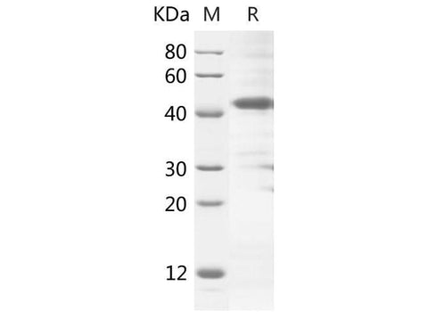 SDS-PAGE analysis of Rat C4a proteins, 2 μg/lane of Recombinant Rat C4a proteins was resolved with SDS-PAGE under reducing conditions, showing bands at 42 kDa.