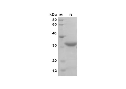 SDS-PAGE analysis of Mouse PROK1 proteins, 2 μg/lane of Recombinant Mouse PROK1 proteins was resolved with SDS-PAGE under reducing conditions, showing bands at 32 kDa.