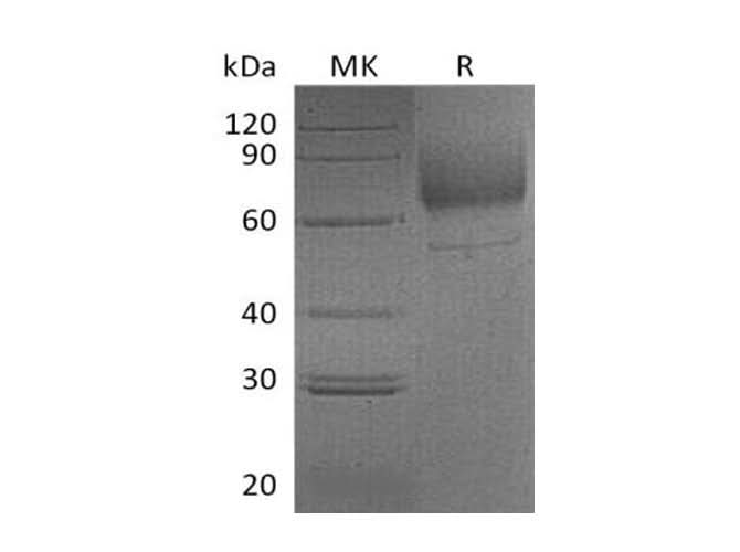 Recombinant Mouse LIMP-2/LIMPII Protein (Fc Tag) - ABMIUM