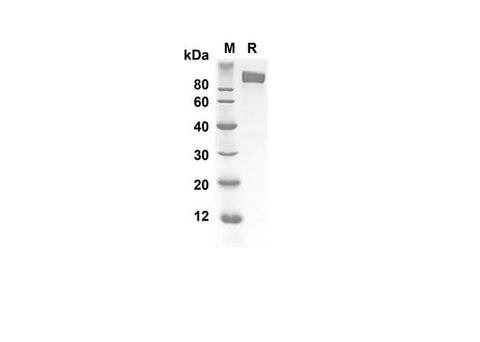 SDS-PAGE analysis of Human IL6ST proteins, 2 μg/lane of Recombinant Human IL6ST proteins was resolved with SDS-PAGE under reducing conditions, showing bands at 90.5 kDa.