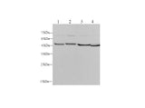 Anti-Human/Mouse/Rat ENO2 Antibody - ABMIUM