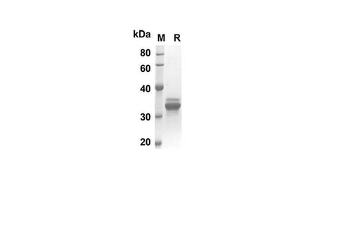 SDS-PAGE analysis of Human CCL25 proteins, 2 μg/lane of Recombinant Human CCL25 proteins was resolved with SDS-PAGE under reducing conditions, showing bands at 33.8 kDa.