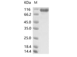 > 95 % as determined by reducing SDS-PAGE.