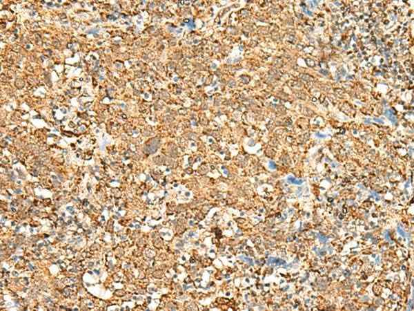 Anti-Human P2RY14 Antibody