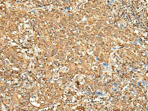 Anti-Human P2RY14 Antibody