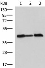 Western blot analysis of A549 Hela and HepG2 cell lysates using PDHA1 Polyclonal Antibody at dilution of 1:750