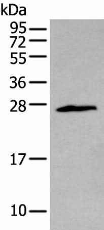 Anti-Human/Mouse/Rat ZNF22 Antibody