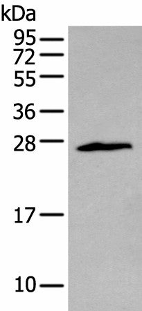 Western blot analysis of Jurkat cell using ZNF22 Polyclonal Antibody at dilution of 1:400