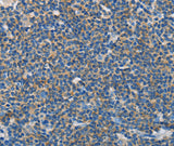 Anti-Human NEK5 Antibody - ABMIUM