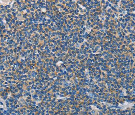 Anti-Human NEK5 Antibody