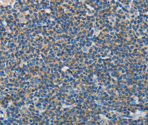 Anti-Human NEK5 Antibody - ABMIUM