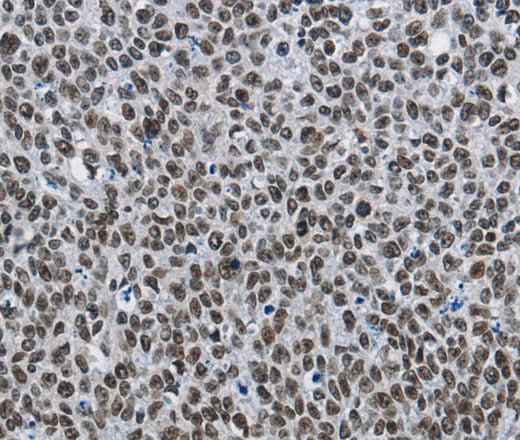 Anti-Human CMTM2 Antibody
